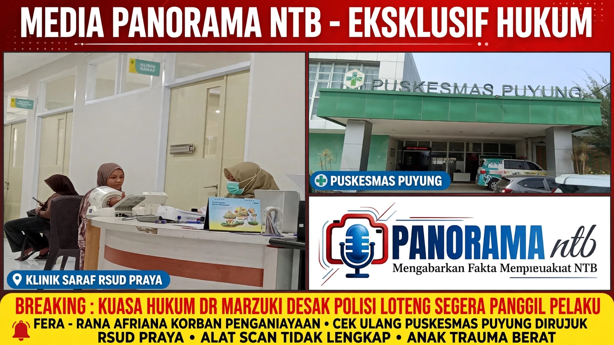 Rena Afriana Dugaan Korban Penganiayaan Dirujuk dari Puskesmas Puyung ke RSUD Praya, Keluhkan Sakit Leher Hingga Muntah Berkelanjutan